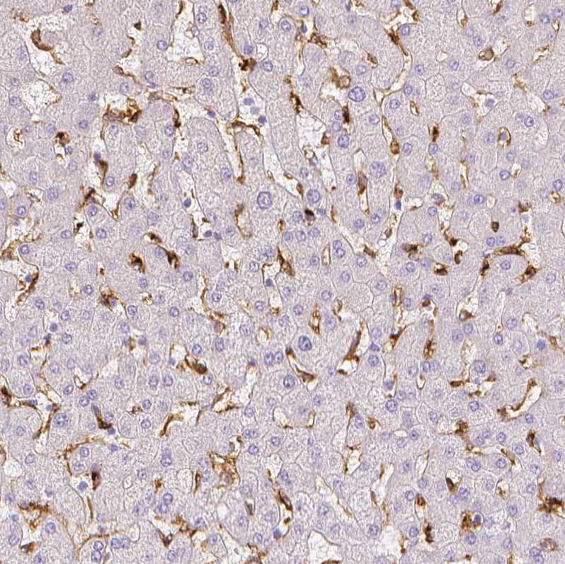 Staining of human liver shows strong cytoplasmic positivity in Kupffer cells.