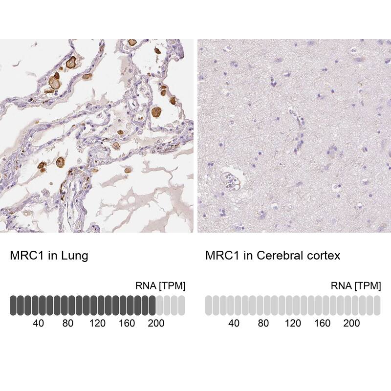 Analysis in human lung and cerebral cortex tissues. Corresponding RNA-seq data are presented for the same tissues.