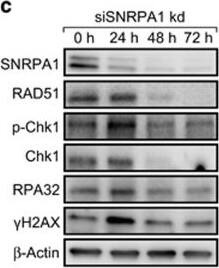Western Blot: SNRPA1 Antibody [NBP2-33447] - Recruitment kinetics of SNRPA1 & SF3A3 after laser microirradiation & SNRPA1-dependent recruitment of RAD51 & BRCA1 to laser tracks. (a) Image-based cytometry reveals increased  gamma H2AX formation after 72 h SNRPA1 knockdown in U2OS cells. SNRPA1 knockdown effciency is shown in the bar graph. U2OS cells transiently (b) or stably (c) expressing SNRPA1-GFP were microirradiated & protein recruitment followed in real-time. For transcription & splicing inhibition cells were pretreated with DRB (50 μM) or SSA (100 nM) for at least 1 h before damage induction. Representative confocal images & recruitment kinetics are shown. (d) As in (b & c) but in cells stably expressing SF3A3-GFP. (e) Generation of R-loops at laser tracks visualized by HB-GFP recruitment. HB-GFP recruitment kinetics resemble SNRPA1-GFP. (f) Schematic of SNRPA1 deletion constructs. (g) Representative confocal images of recruitment of wild-type & mutated GFP-tagged SNRPA1 after laser microirradiation. (h) Quantification of recruitment, non-recruitment & displacement of GFP-tagged SNRPA1 fusions. Ten cells were analyzed per condition. (i) Confirmation of siRNA-mediated depletion of SNRPA1 after 48 & 72 h knockdown in cells used in (j). (j) Recruitment of RAD51 & BRCA1 in control & SNRPA1-depleted U2OS cells. U2OS cells were transfected with control or SNRPA1 siRNA & 48 or 72 h later microirradiated, fixed after indicated repair times & stained for  gamma H2AX, RAD51 & BRCA1. Representative confocal images & percentage of cells displaying RAD51 & BRCA1 recruitment are shown. Scale bar 5 or 10 μM (i). Statistically significant differences were determined using Student's t-test, *P12 foci),  gamma H2AX (>12 foci), BRCA1 (>12 foci) & RPA (>12 foci) positive cells. For each condition, more than 400 cells were analyzed. (c) After indicated time periods of SNRPA1 knockdown, cells were collected & analyzed by western blotting. Forty-eight hours after SNRPA1 depletion, protein expression levels of RAD51 & Chk1 were already reduced. At 24 h after siSNRPA1 transfection,  gamma H2AX levels transiently increased & then declined. The error bars represent s.e.m. from three independent experiments (n=3). Statistically significant differences between cells treated with control or splicing factor siRNA were determined using Student's t-test, *P<0.05, **P<0.01. Scale bar is 10 μm. Image collected & cropped by CiteAb from the following publication (//pubmed.ncbi.nlm.nih.gov/27991914), licensed under a CC-BY license. Not internally tested by Novus Biologicals.