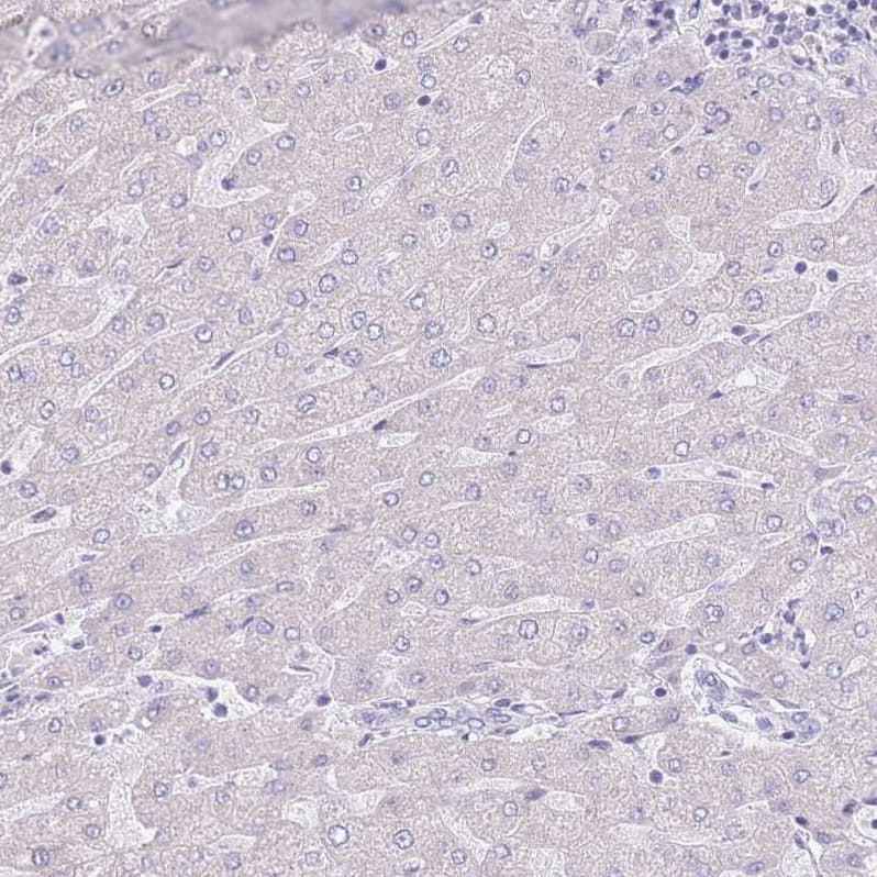 Staining of human liver shows no positivity in hepatocytes as expected.