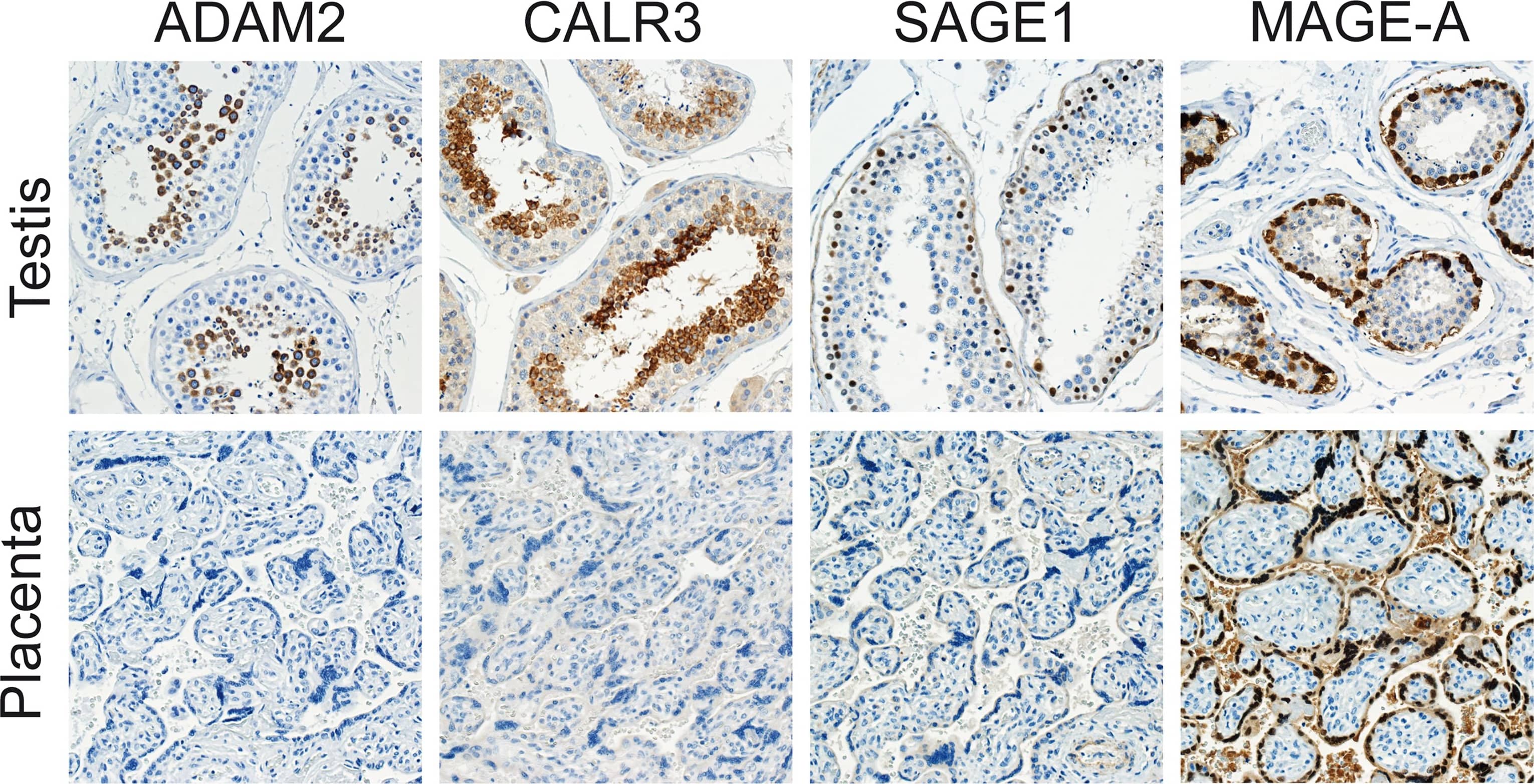 Immunohistochemistry: Calreticulin-2/CALR3 Antibody [NBP2-33524] - Immunohistochemical staining of CT antigens in normal tissues.Among 22 normal tissues (see materials & methods), ADAM2, CALR3, SAGE1 & MAGE-A proteins were only detected in the germ cells of the testis. More specifically, SAGE-1 & MAGE-A were found in spermatogonia, while ADAM2 & CALR3 were present in post-meiotic germ cells. Only MAGE-A proteins were detected in plancenta (all pictures magnification x20). Image collected & cropped by CiteAb from the following publication (//dx.plos.org/10.1371/journal.pone.0134967), licensed under a CC-BY license. Not internally tested by Novus Biologicals.