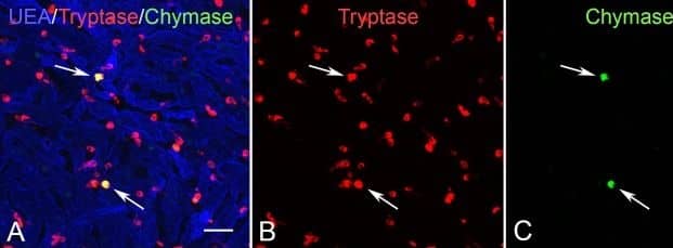 Aged control whole mount choroid immunolabeled for (A) UEA lectin (blue), (B) tryptase (red), and (C) chymase (green). The vast majority of human choroidal MCs are of the MCT phenotype (tryptase+/chymase−). Only a small percentage of MCs are MCtc (tryptase+/chymase+) (arrows). Scale bar: 30 μm.