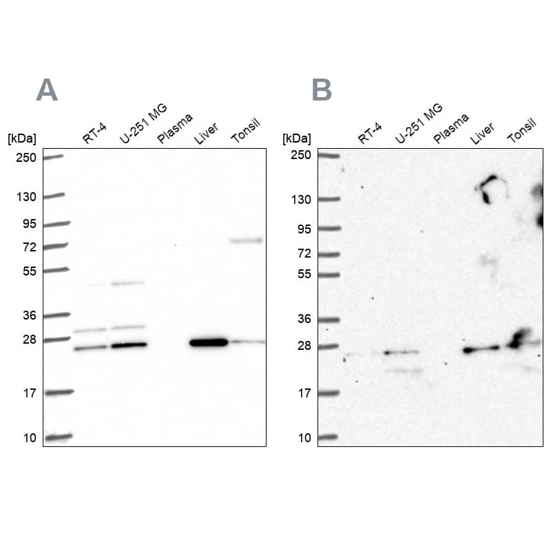 <b>Independent Antibodies Validation. </b>Analysis using NBP2-33692 (A) shows similar pattern to independent antibody NBP2-34115 (B).