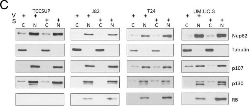 Western Blot: p107 Antibody [NBP2-33735] - Selinexor alters pocket protein expression in nuclear & cytoplasmic compartments(A) Representative images of p107, p130 & RB (green) IF staining of bladder cancer cells treated with vehicle (V) or selinexor (S) for 48 hours. Tubulin staining (red) & DAPI staining (blue) served to define the cytoplasmic & nuclear compartments, respectively. The inserts are magnifications of the boxed cells. (B) Quantification of staining intensity of pocket proteins normalized to DAPI. (C) Nuclear & cytoplasmic fractions of cell treated with vehicle or 0.15 uM selinexor (UM-UC-3 & T24 cells), 0.25 uM selinexor (J82) & 0.5 uM selinexor (TCCSUP) for 72 hours were assessed for the expression of RB, p107 & p130. Nup62 & tubulin were used as markers for the nuclear & cytoplasmic fractions, respectively. (D) T24 & UM-UC-3 cells transfected with siC or siRB & were treated with vehicle or 0.1 uM selinexor for 72 hours. The results are shown as percent cell viability comparing drug treated to vehicle treated cells. (E) Palbociclib reduces T24 & UM-UC-3 bladder tumor cells viability in a dose dependent manner. (F) Combined selinexor (0.1 uM) & palbociclib (0.5 uM) treatment is more effective in reducing viability of cells than either treatment alone where the CI = 1.04 for UM-UC-3 cells & 1.02 for T24 cells indicating an additive response. Error bars = ± standard deviation. Student’s t test; * denotes p ≤ 0.05, ** denotes p ≤ 0.01. Image collected & cropped by CiteAb from the following publication (//pubmed.ncbi.nlm.nih.gov/30349650), licensed under a CC-BY license. Not internally tested by Novus Biologicals.