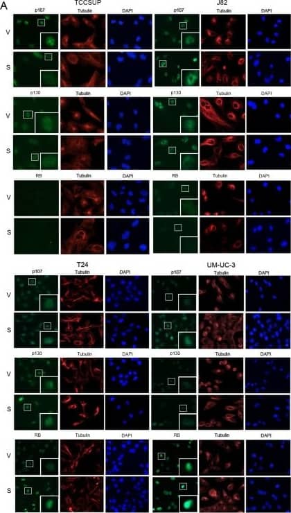 Immunocytochemistry/ Immunofluorescence: p107 Antibody [NBP2-33735] - Selinexor alters pocket protein expression in nuclear & cytoplasmic compartments(A) Representative images of p107, p130 & RB (green) IF staining of bladder cancer cells treated with vehicle (V) or selinexor (S) for 48 hours. Tubulin staining (red) & DAPI staining (blue) served to define the cytoplasmic & nuclear compartments, respectively. The inserts are magnifications of the boxed cells. (B) Quantification of staining intensity of pocket proteins normalized to DAPI. (C) Nuclear & cytoplasmic fractions of cell treated with vehicle or 0.15 uM selinexor (UM-UC-3 & T24 cells), 0.25 uM selinexor (J82) & 0.5 uM selinexor (TCCSUP) for 72 hours were assessed for the expression of RB, p107 & p130. Nup62 & tubulin were used as markers for the nuclear & cytoplasmic fractions, respectively. (D) T24 & UM-UC-3 cells transfected with siC or siRB & were treated with vehicle or 0.1 uM selinexor for 72 hours. The results are shown as percent cell viability comparing drug treated to vehicle treated cells. (E) Palbociclib reduces T24 & UM-UC-3 bladder tumor cells viability in a dose dependent manner. (F) Combined selinexor (0.1 uM) & palbociclib (0.5 uM) treatment is more effective in reducing viability of cells than either treatment alone where the CI = 1.04 for UM-UC-3 cells & 1.02 for T24 cells indicating an additive response. Error bars = ± standard deviation. Student’s t test; * denotes p ≤ 0.05, ** denotes p ≤ 0.01. Image collected & cropped by CiteAb from the following publication (//pubmed.ncbi.nlm.nih.gov/30349650), licensed under a CC-BY license. Not internally tested by Novus Biologicals.