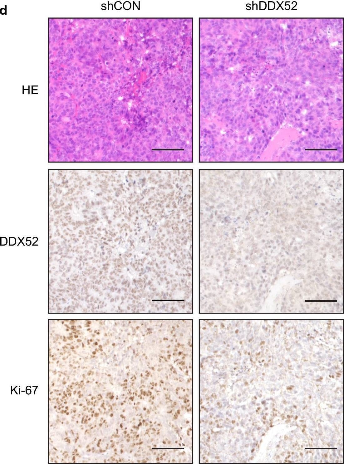 Immunohistochemistry DDX52 Antibody - BSA Free