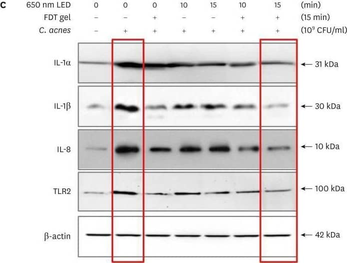 (A, B) mRNA expression changes of acne inflammatory markers in sqRT-PCR. The reduction of inflammatory markers was large in the PDT group in which FDT gel and LED irradiation were applied together, in particular, it was greatest in the group in which LED irradiation was applied for 15 minutes. (C, D) Protein expression changes of acne inflammatory markers as indicated by Western blot analysis. The reduction of inflammatory markers was large in the PDT group in which FDT gel and LED irradiation were applied together; in particular, the greatest change was in the group in which LED irradiation was applied for 15 minutes. (B, D) * indicates p<0.05 statistical significance.IL: interleukin, TNF: tumor necrosis factor, TLR: Toll-like receptor, MMP: matrix metalloproteinase. Image collected and cropped by CiteAb from the following open publication (//pubmed.ncbi.nlm.nih.gov/39623608), licensed under a CC-BY license. Not internally tested by Novus Biologicals.