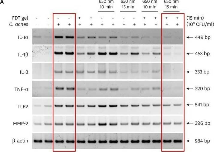 (A, B) mRNA expression changes of acne inflammatory markers in sqRT-PCR. The reduction of inflammatory markers was large in the PDT group in which FDT gel and LED irradiation were applied together, in particular, it was greatest in the group in which LED irradiation was applied for 15 minutes. (C, D) Protein expression changes of acne inflammatory markers as indicated by Western blot analysis. The reduction of inflammatory markers was large in the PDT group in which FDT gel and LED irradiation were applied together; in particular, the greatest change was in the group in which LED irradiation was applied for 15 minutes. (B, D) * indicates p<0.05 statistical significance.IL: interleukin, TNF: tumor necrosis factor, TLR: Toll-like receptor, MMP: matrix metalloproteinase. Image collected and cropped by CiteAb from the following open publication (//pubmed.ncbi.nlm.nih.gov/39623608), licensed under a CC-BY license. Not internally tested by Novus Biologicals.