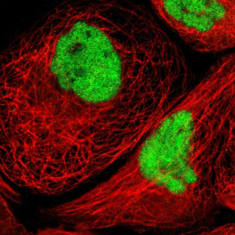 Staining of human cell line A-431 shows localization to nucleoplasm.
