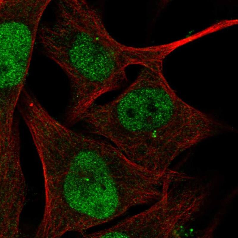 Staining of human cell line SK-MEL-30 shows localization to nucleoplasm & centrosome.