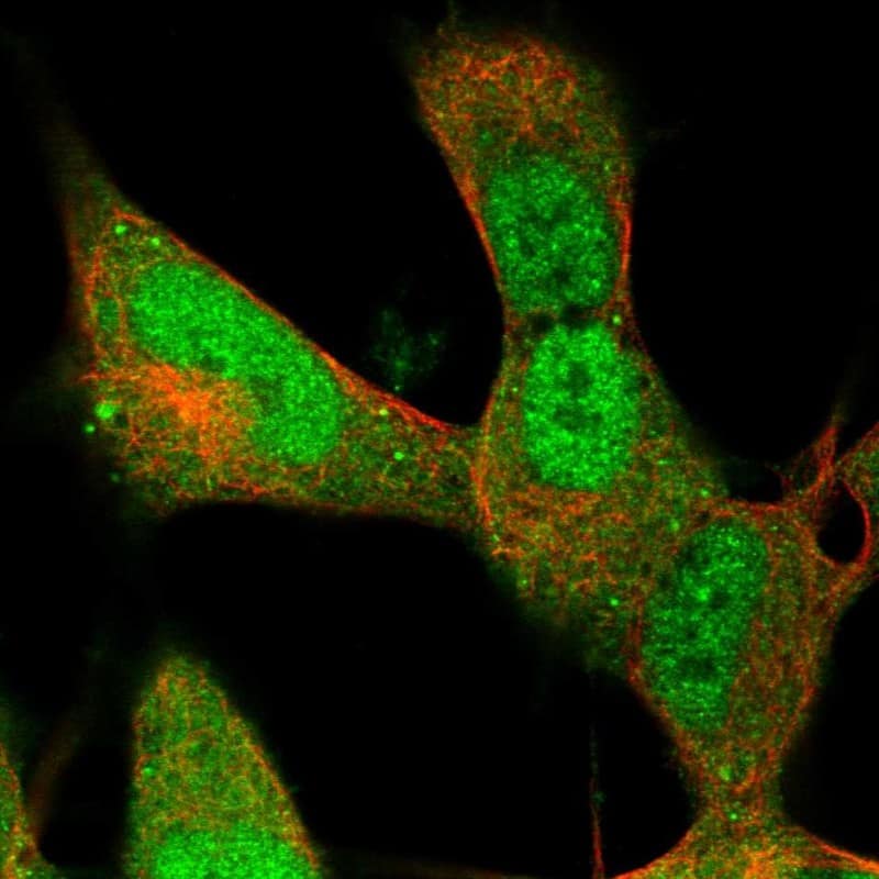 Staining of human cell line SH-SY5Y shows localization to nucleoplasm & cytosol.