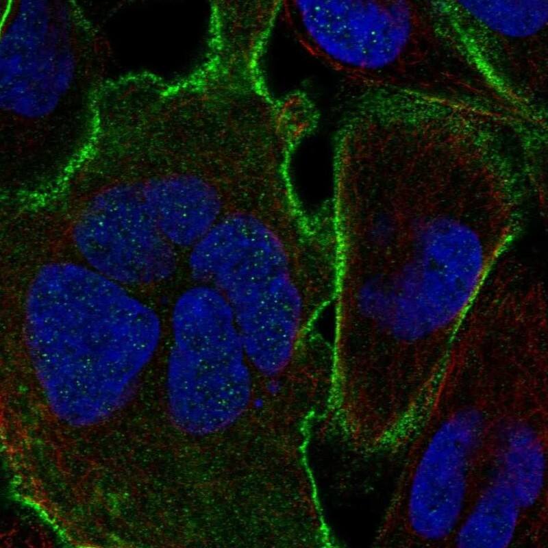 Staining of human cell line RH-30 shows localization to plasma membrane.