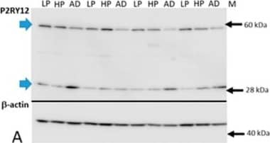 Quantitative biochemical measurements of P2RY12 protein and mRNA in human brains. (A–C). Western blot measurements of P2RY12 levels in MTG samples from LP, HP and AD brains. (A). Representative western blot image of P2RY12 polypeptide of MTG protein extracts identified with Novus antibody. Blots were normalized for levels of  beta  actin. (B). Scatter plot showing individual P2RY12 expression levels. Significant decrease in protein levels of 58 kDa full-length P2RY12 band in AD (green shapes) compared to LPND (black) and HPND (red) cases. Chart indicates mean + Standard error of mean (SEM). Statistical analysis by one-way ANOVA with Tukey post-hoc test (F2,26 = 11.54, p 0.05). Abbreviations: LPND: low plaque non-demented. HPND: high plaque non-demented. AD: Alzheimer’s disease. NS: non-significant. * p < 0.05, ** p < 0.01,*** p < 0.001. Image collected and cropped by CiteAb from the following open publication (//pubmed.ncbi.nlm.nih.gov/31968618), licensed under a CC-BY license. Not internally tested by Novus Biologicals.