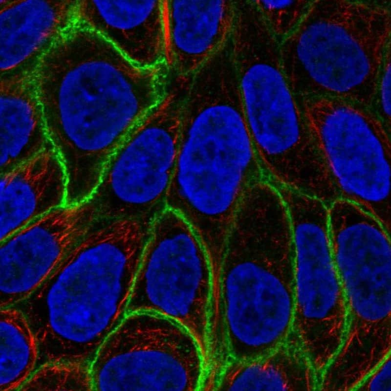 Staining of human cell line RT4 shows localization to plasma membrane.