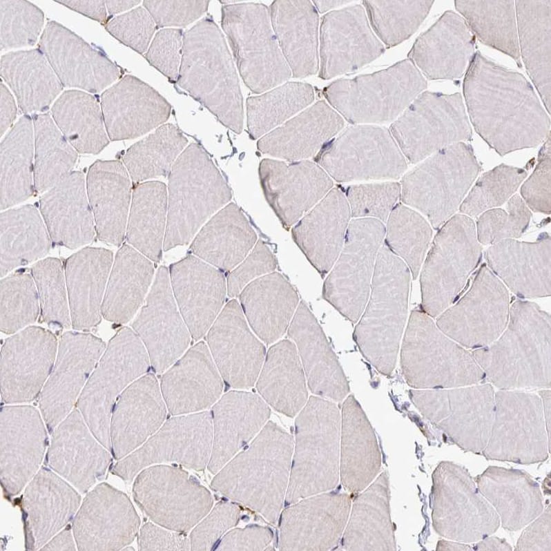 Staining of human skeletal muscle shows no positivity in myocytes as expected.