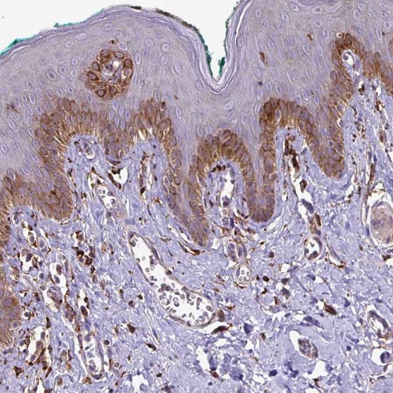 Staining of human skin shows strong cytoplasmic positivity in squamous epithelial cells.