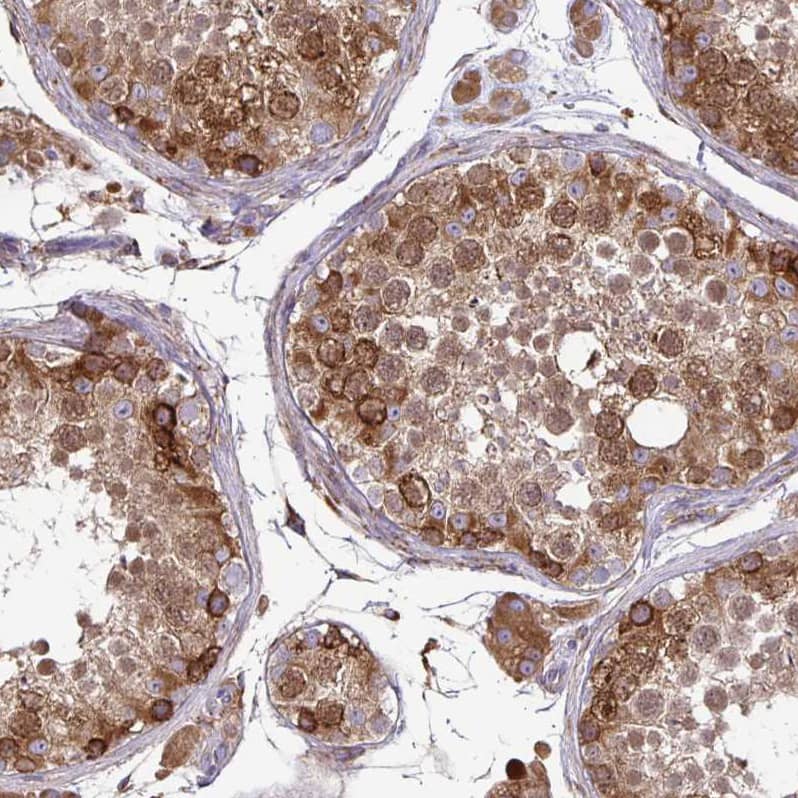Staining of human testis shows strong cytoplasmic positivity in cells in seminiferous ducts.