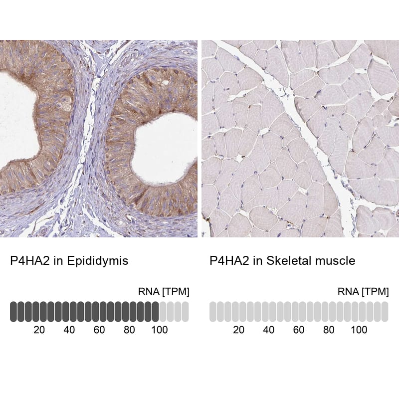 Analysis in human epididymis and skeletal muscle tissues. Corresponding RNA-seq data are presented for the same tissues.
