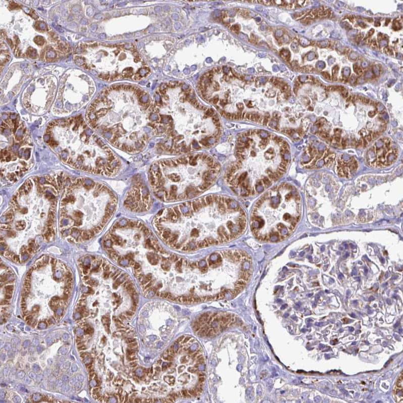 Staining of human kidney shows strong cytoplasmic positivity in cells in tubules.