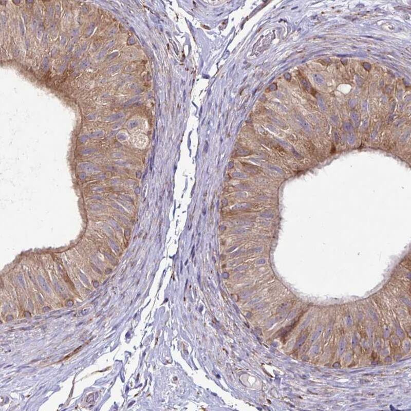 Staining of human epididymis shows high expression.