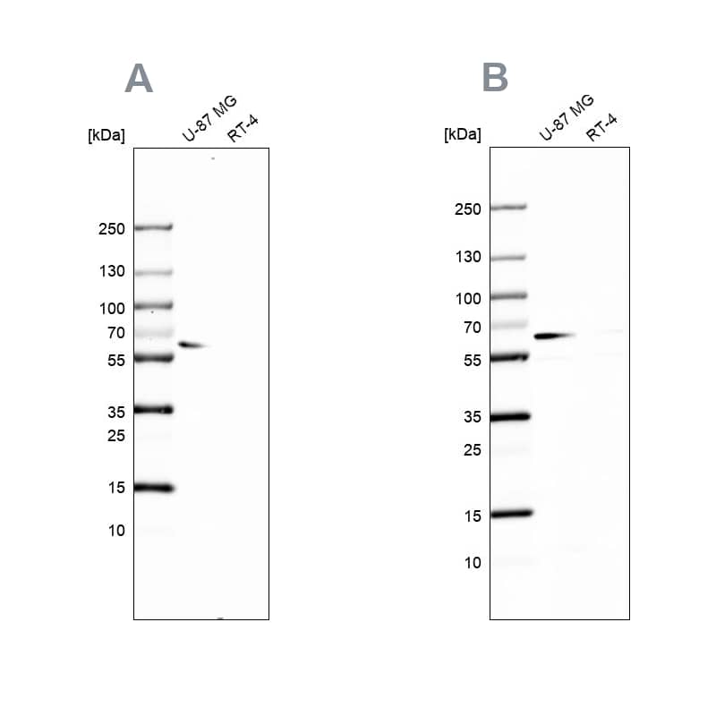 <b>Independent Antibodies Validation. </b>Analysis using NBP2-33878 (A) shows similar pattern to independent antibody NBP2-33909 (B).