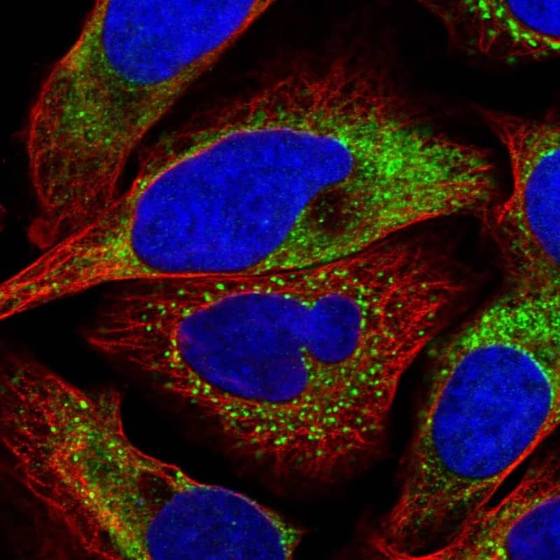 Staining of human cell line U-2 OS shows localization to endoplasmic reticulum & vesicles.