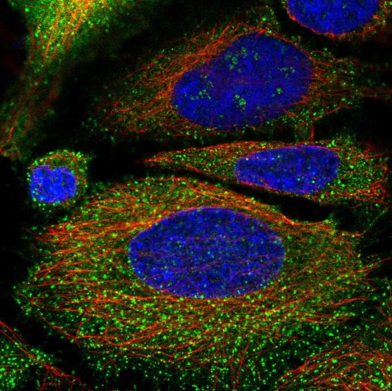 Staining of human cell line HeLa shows localization to nucleoli fibrillar center, plasma membrane & vesicles.