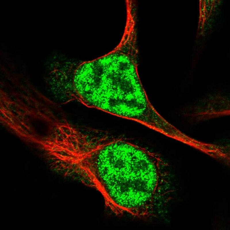 Immunocytochemistry/ Immunofluorescence RAD54L Antibody - BSA Free