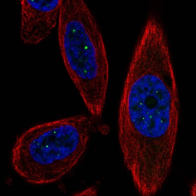 Immunocytochemistry/ Immunofluorescence SSTK-IP Antibody - BSA Free