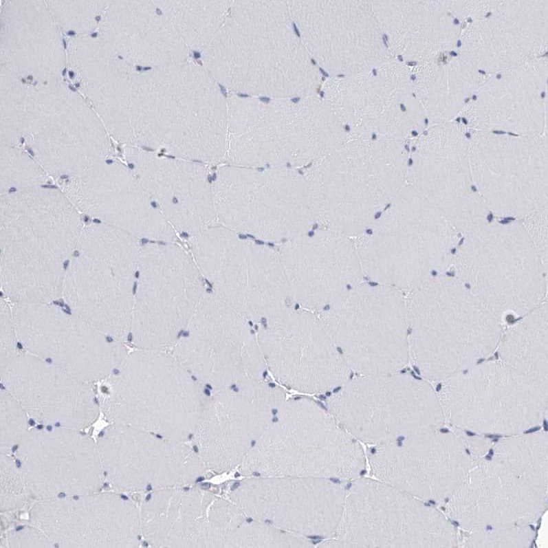Immunohistochemistry-Paraffin SerpinB9 Antibody - BSA Free
