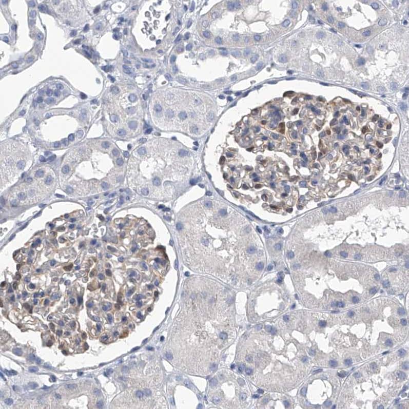 Immunohistochemistry-Paraffin SerpinB9 Antibody - BSA Free