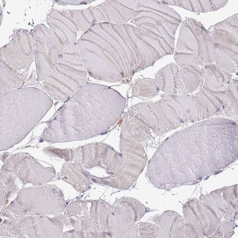 Immunohistochemistry-Paraffin Lipin 2 Antibody - BSA Free