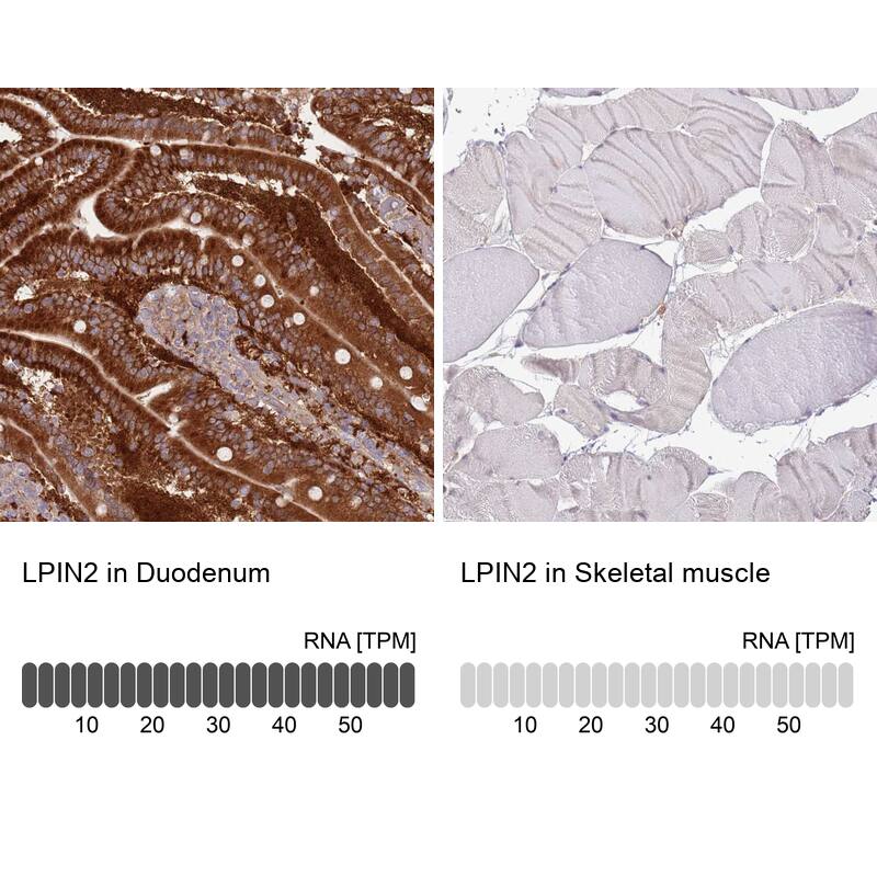 Immunohistochemistry-Paraffin Lipin 2 Antibody - BSA Free