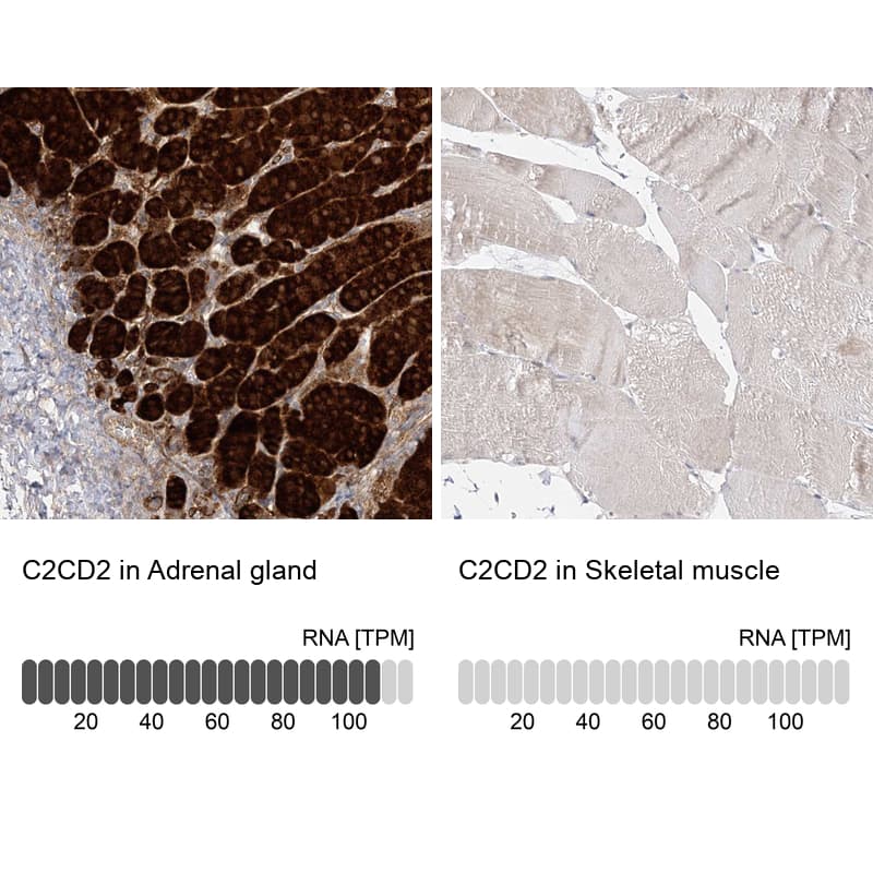 <b>Orthogonal Strategies Validation. </b>Analysis in human adrenal gland and skeletal muscle tissues.