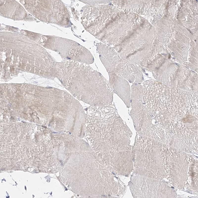 Staining of human skeletal muscle shows low expression as expected.
