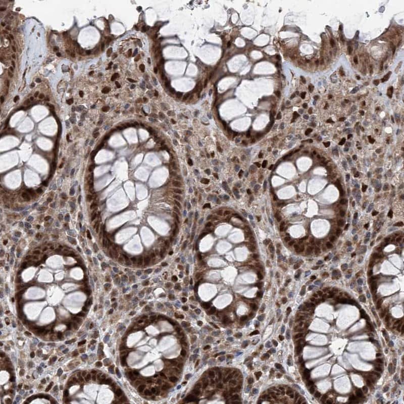 Staining of human rectum shows strong nuclear and cytoplasmic positivity in glandular cells.