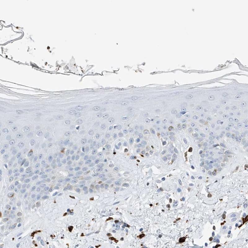 Staining of human skin shows low expression as expected.