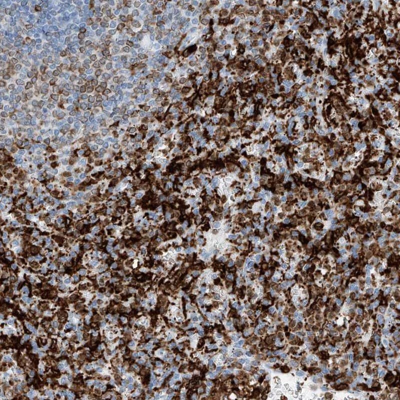 Staining of human spleen shows high expression.