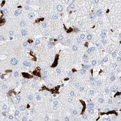 Staining of human liver.
