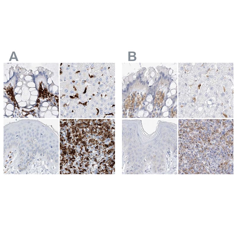 <b>Orthogonal Strategies Validation. </b>Staining of human colon, liver, skin and spleen HPA031259 (A) shows similar protein distribution across tissues to independent antibody HPA031258 (B).