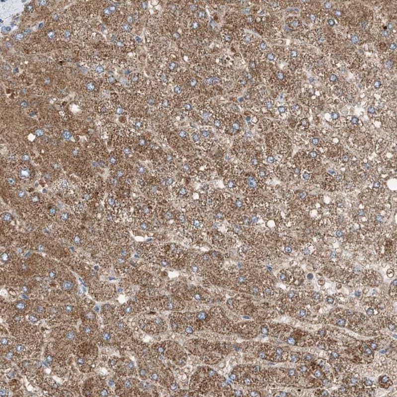 Staining of human liver shows strong cytoplasmic granular positivity in hepatocytes.