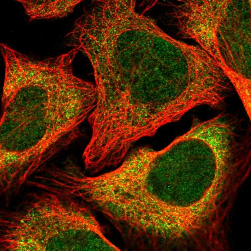 Staining of human cell line U-2 OS shows localization to cytosol.