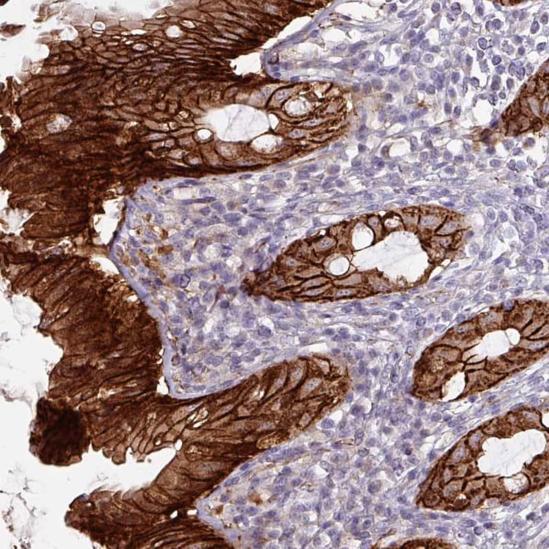 Staining of human rectum shows strong cytoplasmic and membranous positivity in glandular cells.