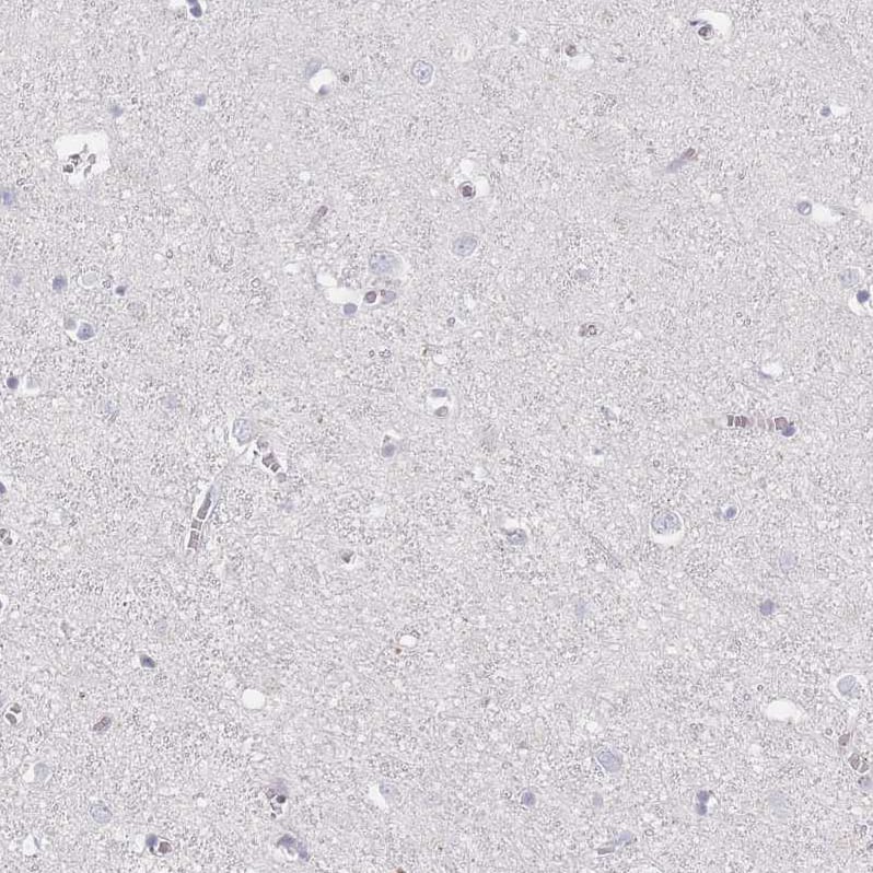 Staining of human cerebral cortex shows no positivity in neurons as expected.