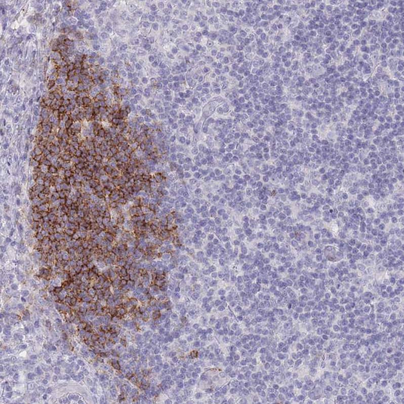 Staining of human lymph node shows strong membranous positivity in non-germinal center cells.
