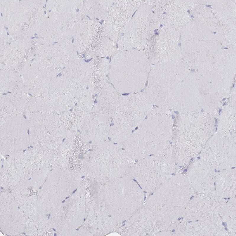 Staining of human skeletal muscle shows no positivity in myocytes as expected.