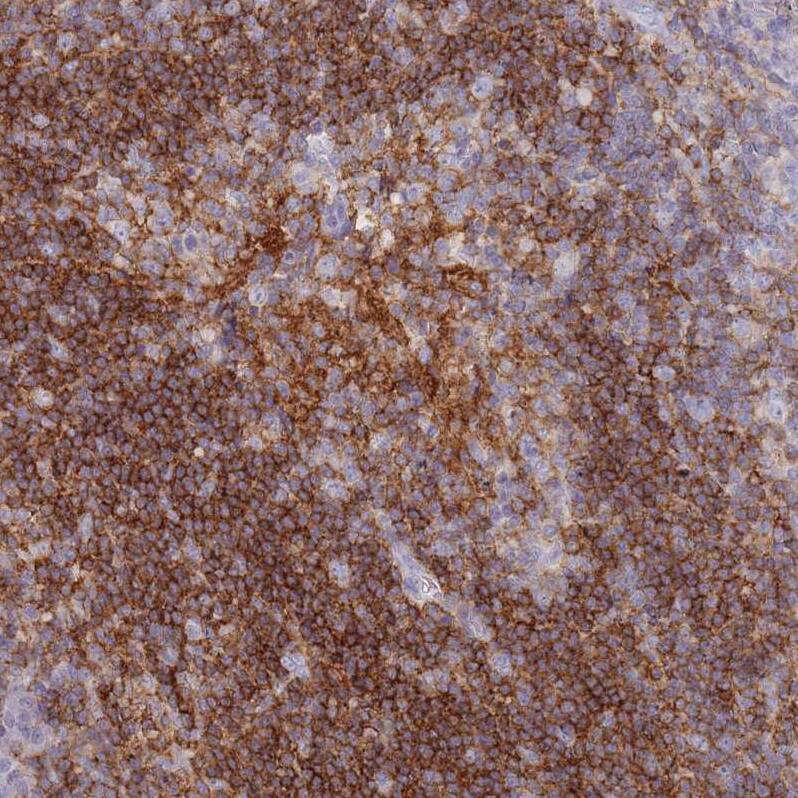 Staining of human tonsil shows strong membranous positivity in non-germinal center cells.