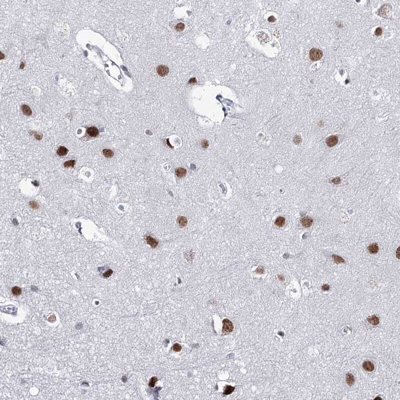 Staining of human cerebral cortex shows strong nuclear positivity in neuronal cells.
