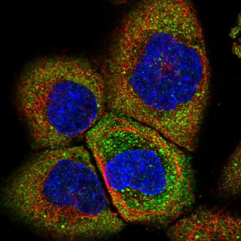 Staining of human cell line A-431 shows localization to cytosol.