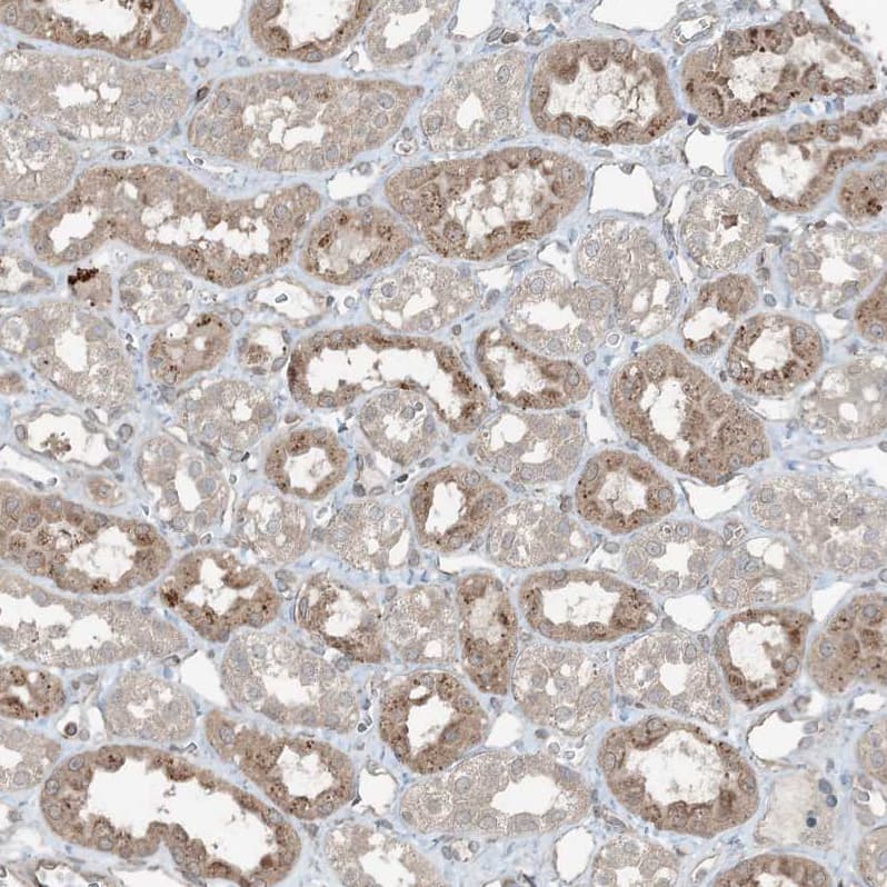 Staining of human kidney shows moderate granular cytoplasmic positivity in cells in tubules.